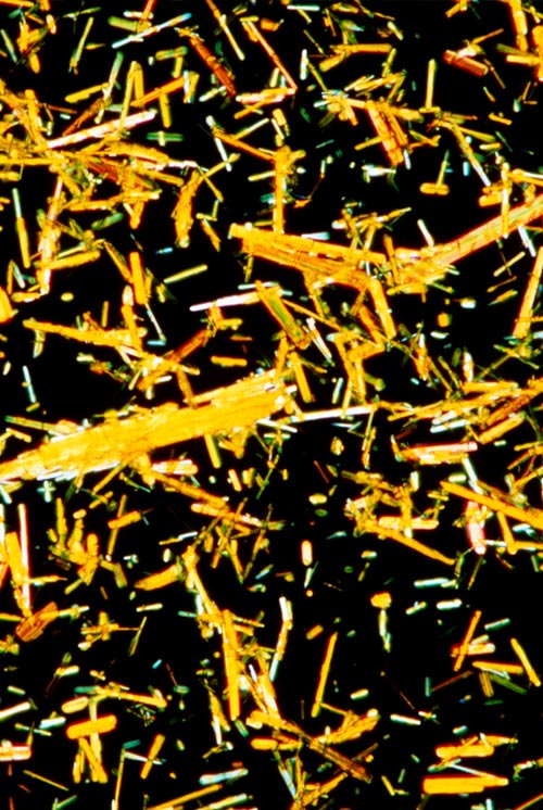 Mikrographische Aufnahme von Vitamin-B<sub>2</sub>-Kristallen